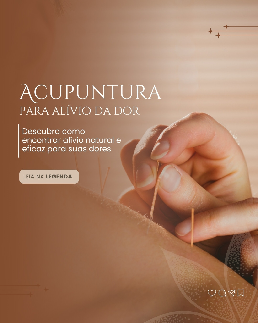 acupuntura (1)