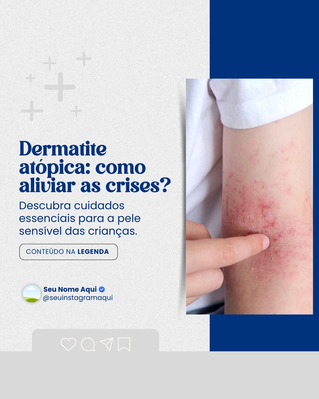 alergia infantil (1)