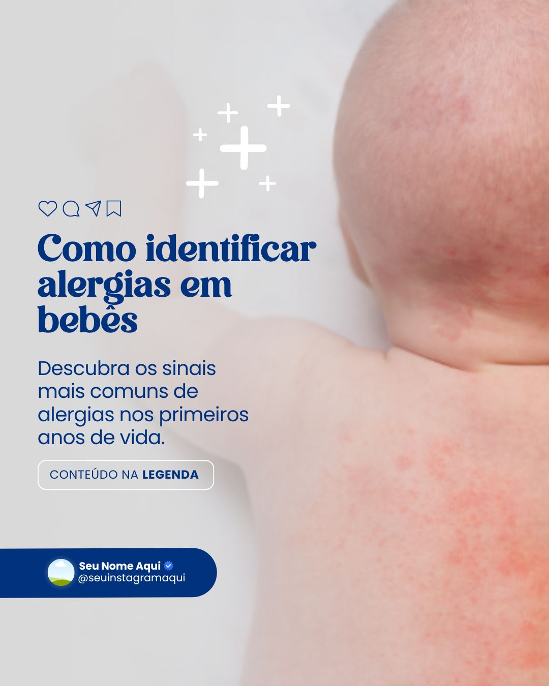 alergia infantil (8)