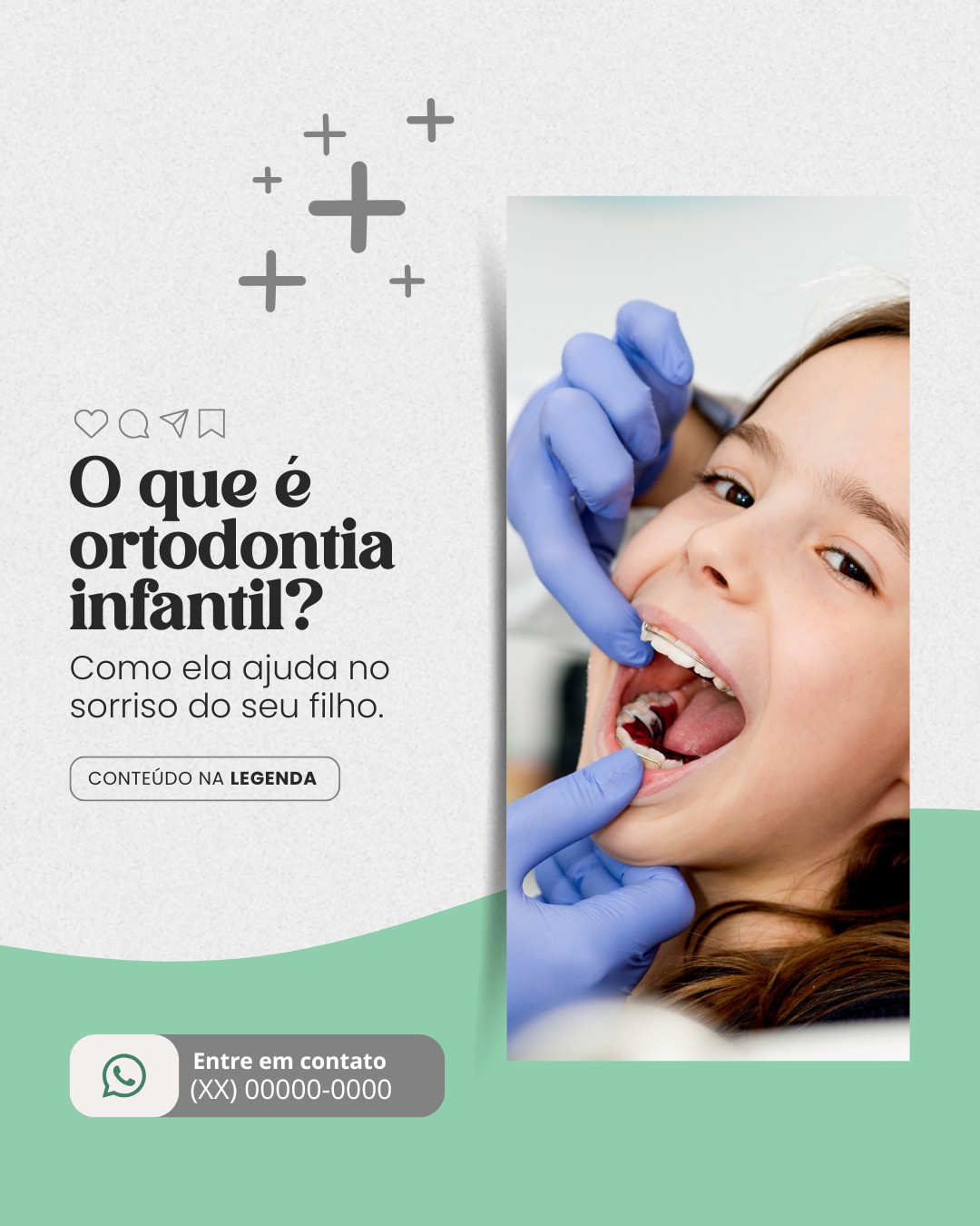 ortodontia infantil (1)