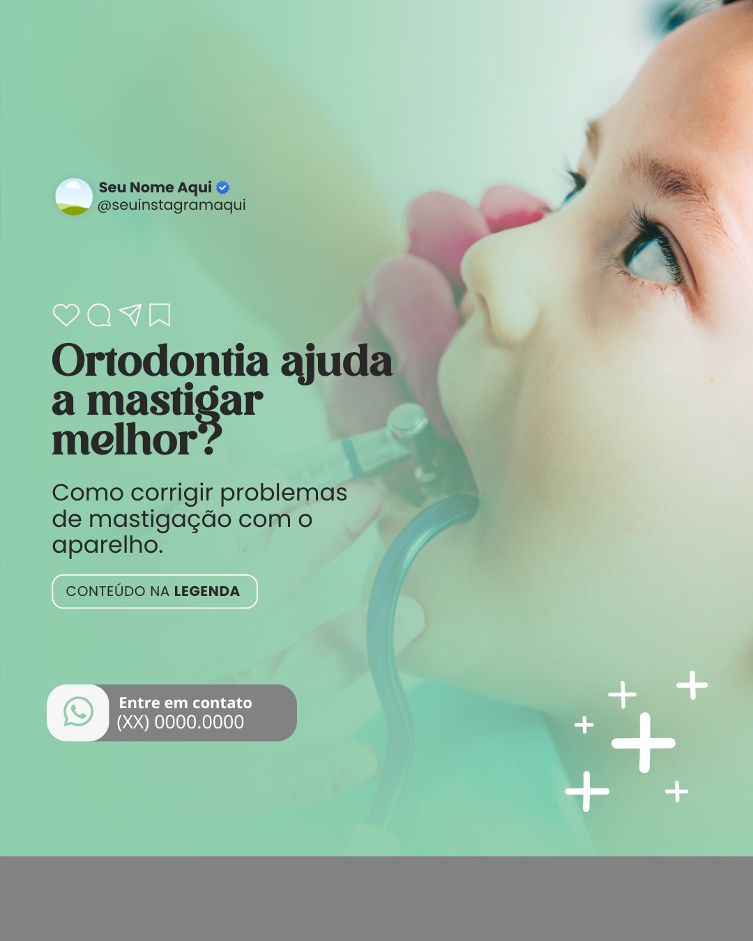 ortodontia infantil (10)