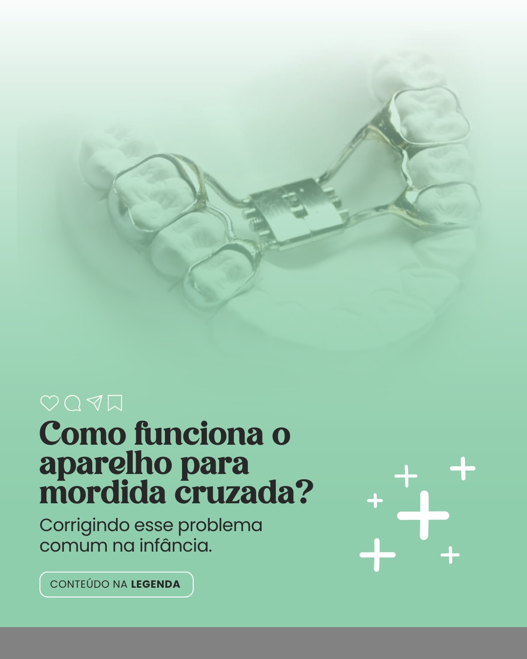 ortodontia infantil (9)