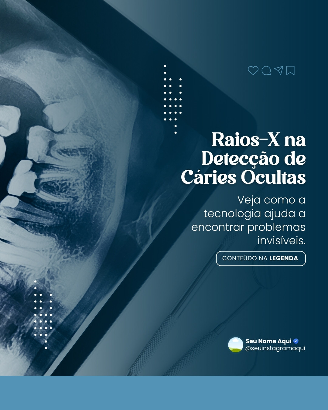 radiologia odontológica (10)