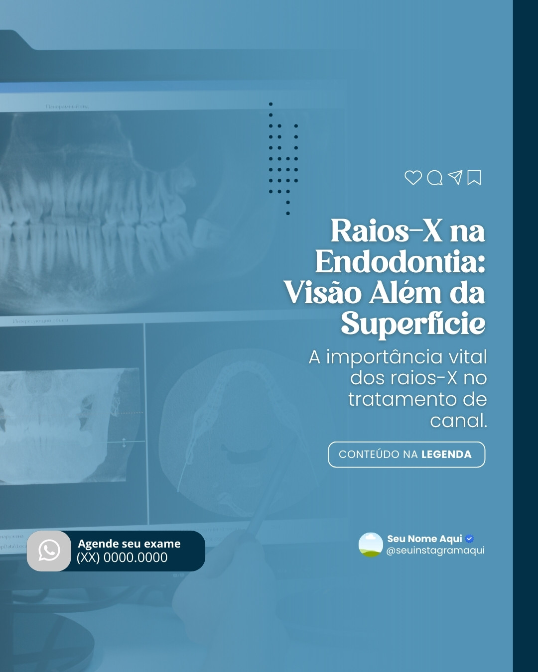 radiologia odontológica (6)