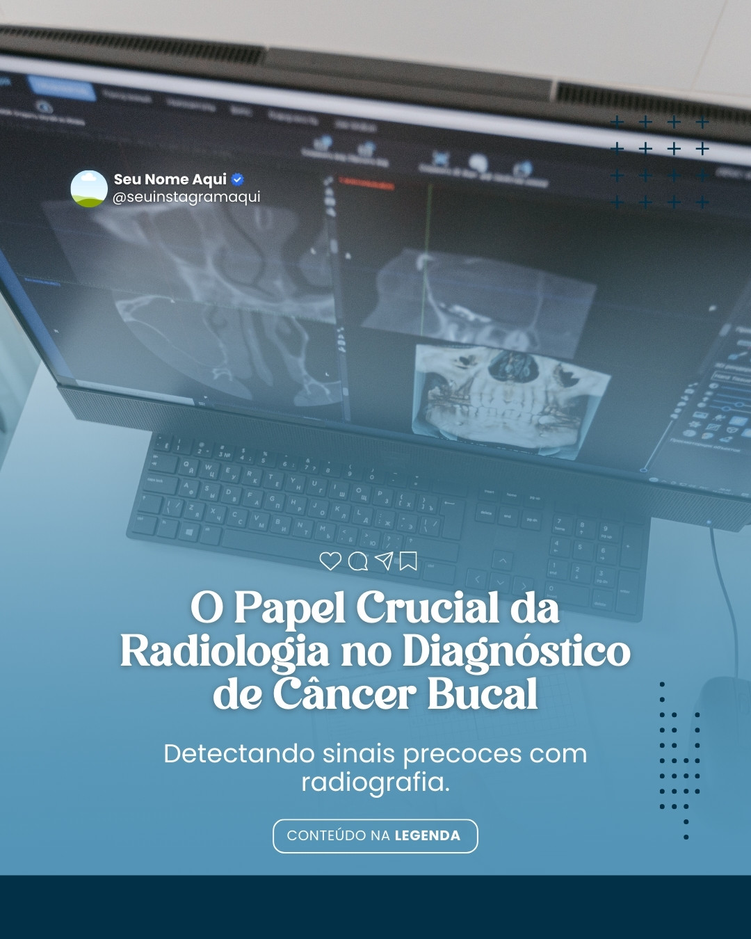 radiologia odontológica (8)